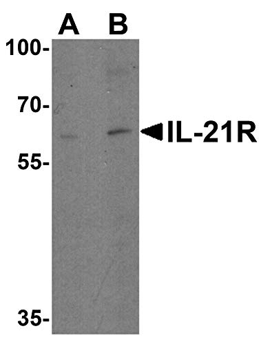 Az IL-21 Receptor Antitest