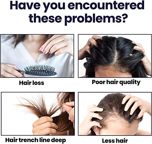 NEPCAT Blusoms HairGrowth Formula Szérum Spray, Ashwagandha 4500 Haj Növekedését Spray, Blusoms HairGrowth Szérum, Megakadályozza